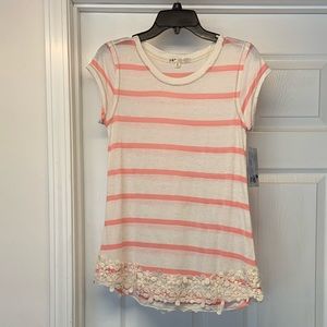 Jolt Striped Top with Lace Detail